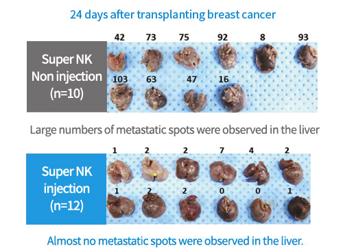 24 days after transplanting breast cancer