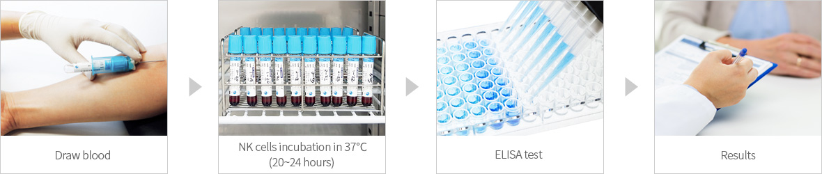 NK Vue® Kit检查方法 : 采血 → 在37℃培养 (20~24小时) → ELISA检查 → 确认结果