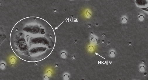 활성 낮은 NK세포 사진